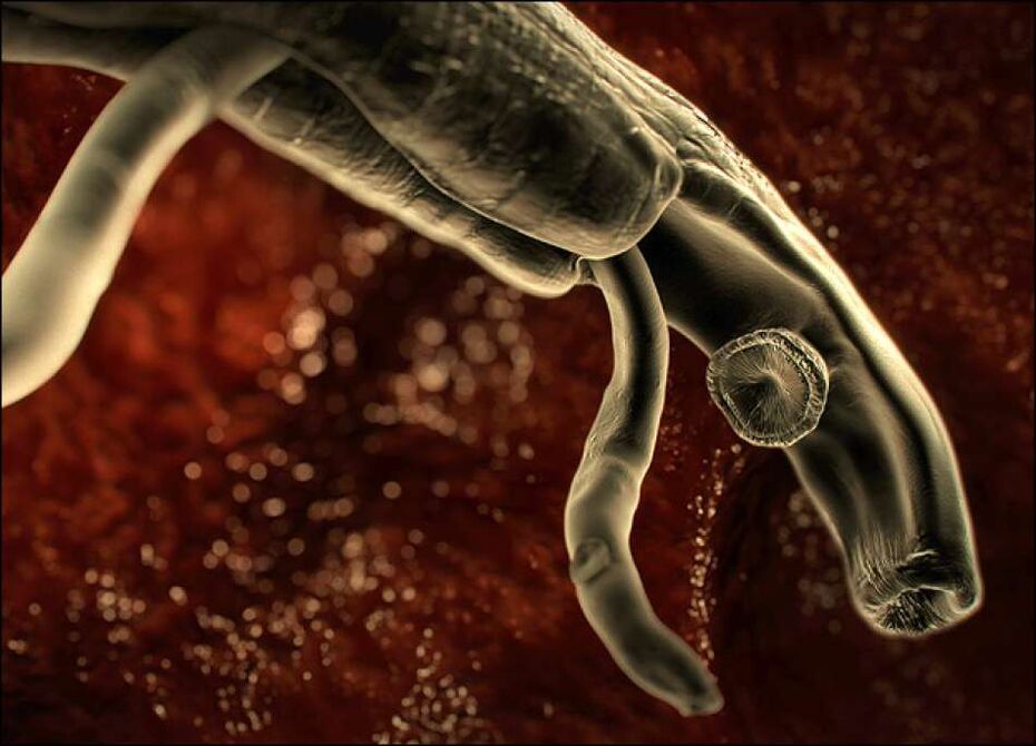 Parasites dans le corps humain