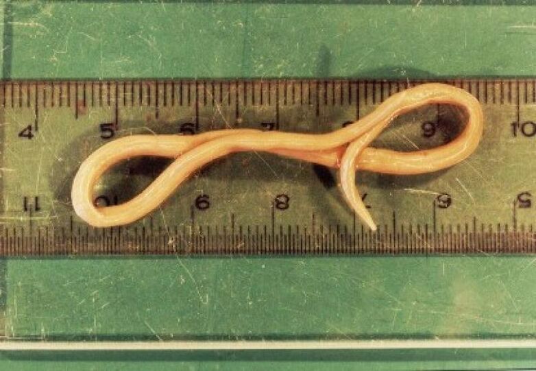 Parasite des ascaris du corps humain