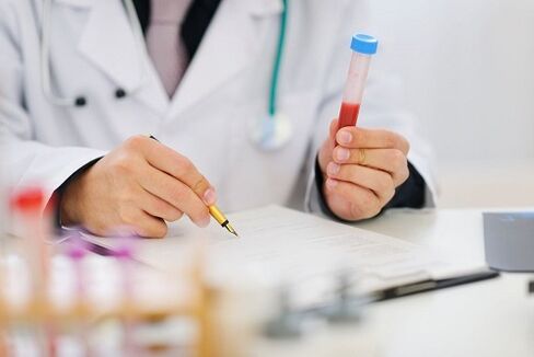 Tests de parasites
