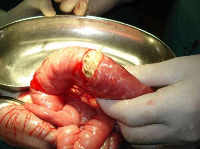 Ces parasites sont dangereux pour l'homme
